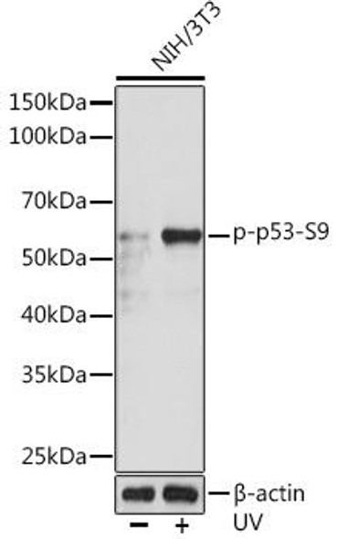 Anti-Phospho-p53-S9 Antibody (CABP0985)