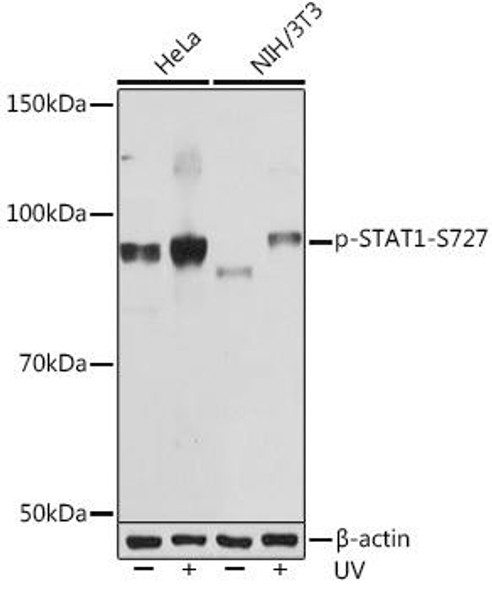 Anti-Phospho-STAT1-S727 Antibody (CABP1000)