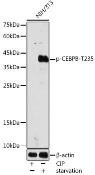 Anti-Phospho-CEBPB-T235 Antibody (CABP1055)