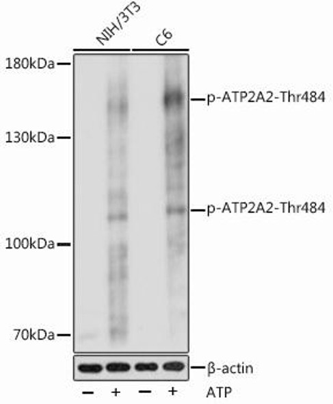 Anti-Phospho-ATP2A2-Thr484 Antibody (CABP1070)