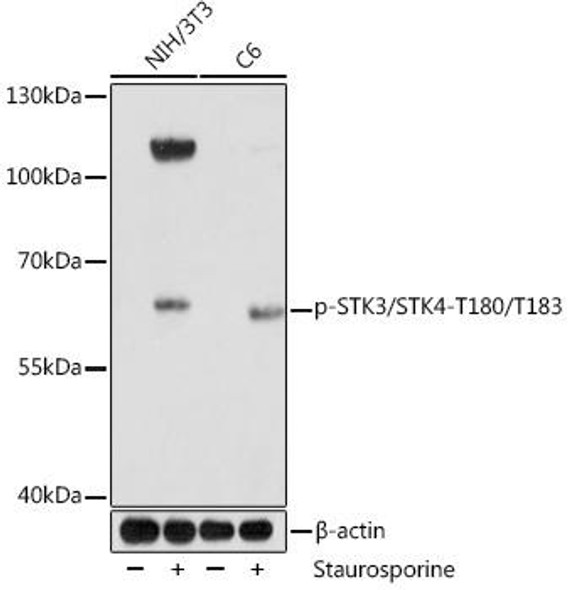 Anti-Phospho-STK3/STK4-T180/T183 Antibody (CABP1094)