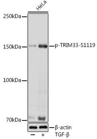 Anti-Phospho-TRIM33-S1119 Antibody (CABP1194)