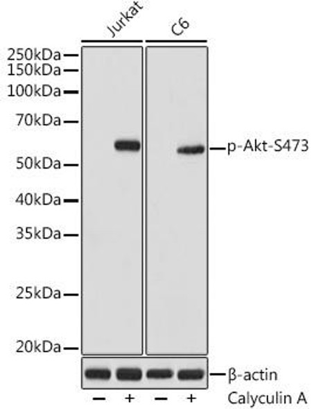Anti-Phospho-AKT1-S473+AKT2-S474+AKT3-S472 Antibody (CABP1208)