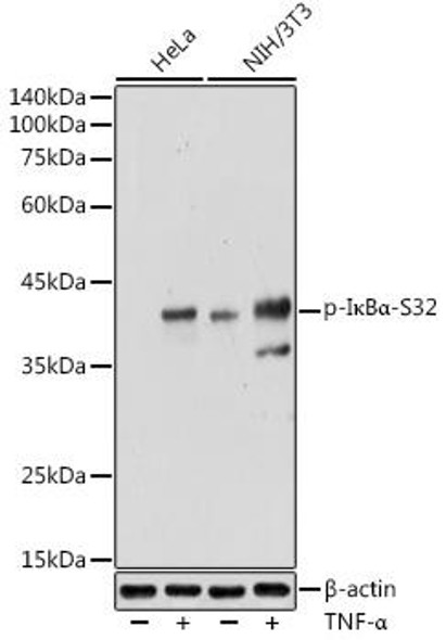 Anti-Phospho-I?Balpha-S32 Antibody (CABP1220)