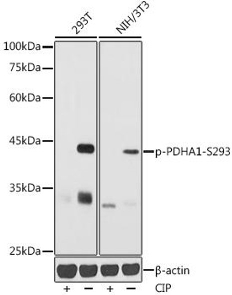 Anti-Phospho-PDHA1-S293 Antibody (CABP1250)