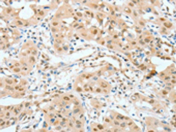 ATF2 Antibody (PACO14115)