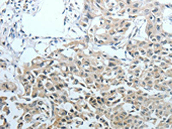 CEACAM1 Antibody (PACO14235)