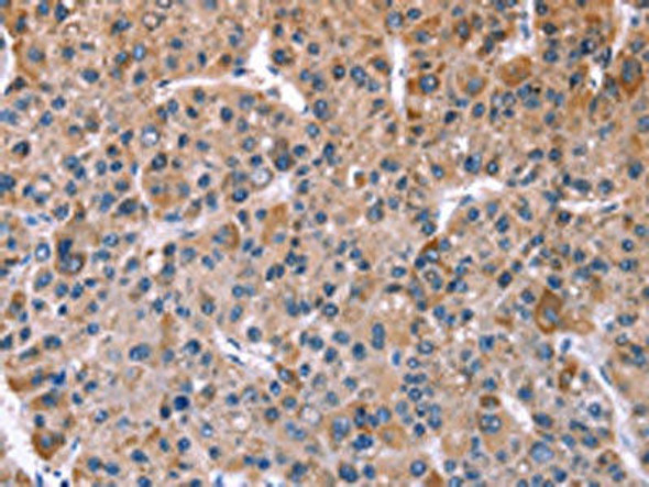 CHRM1 Antibody (PACO14247)