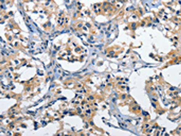 CLEC2D Antibody (PACO14259)