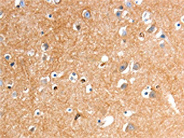 GLP1R Antibody (PACO14467)