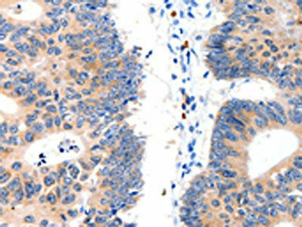 LAT2 Antibody (PACO14639)