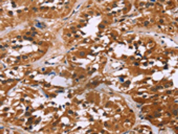 LMNB1 Antibody (PACO14650)