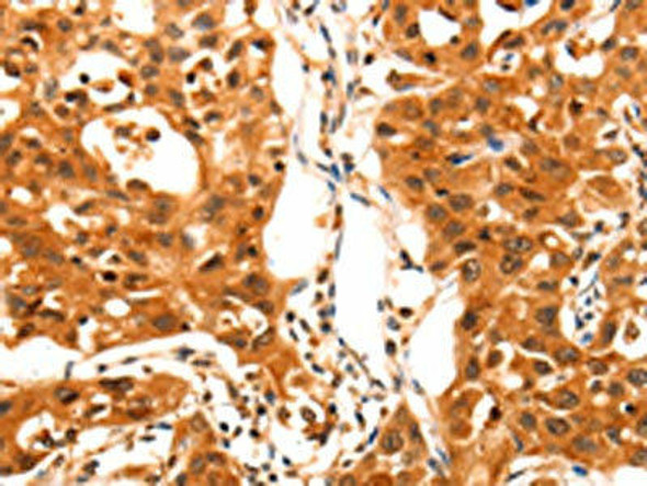 SERPINB5 Antibody (PACO14683)