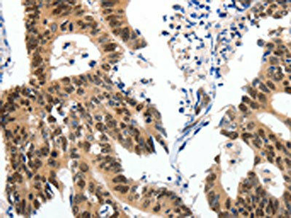 MCM7 Antibody (PACO14694)