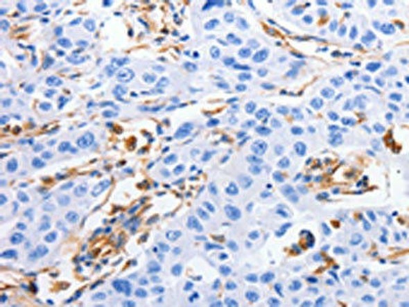 MFN1 Antibody (PACO14698)