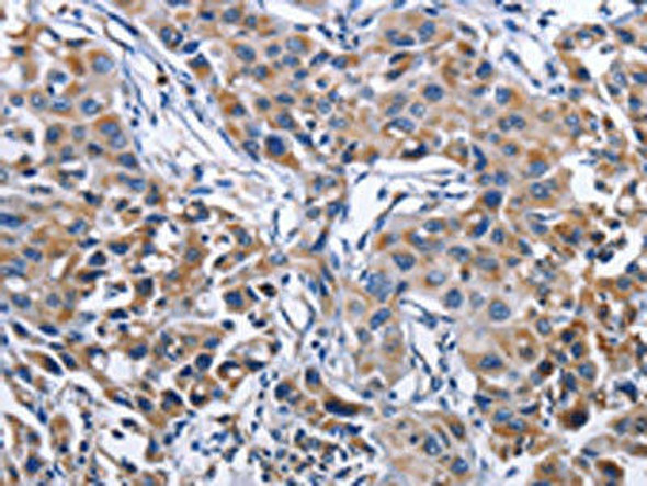 MPO Antibody (PACO14718)