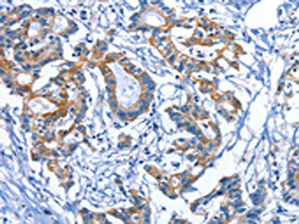 MYH1 Antibody (PACO14744)