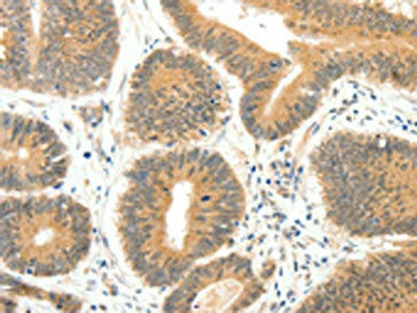 SERPINE1 Antibody (PACO14829)