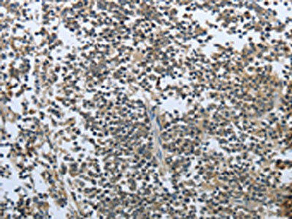 PRL Antibody (PACO14916)