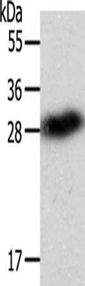 SPIN2B Antibody (PACO15036)