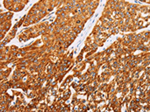 SYVN1 Antibody (PACO15072)