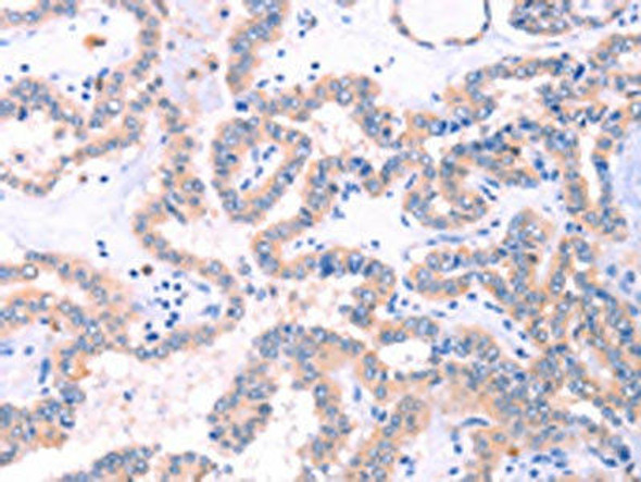 STXBP2 Antibody (PACO15183)