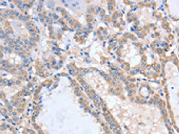 ACVR1C Antibody (PACO15276)