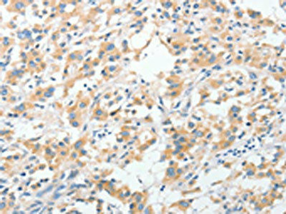 RPN1 Antibody (PACO15611)