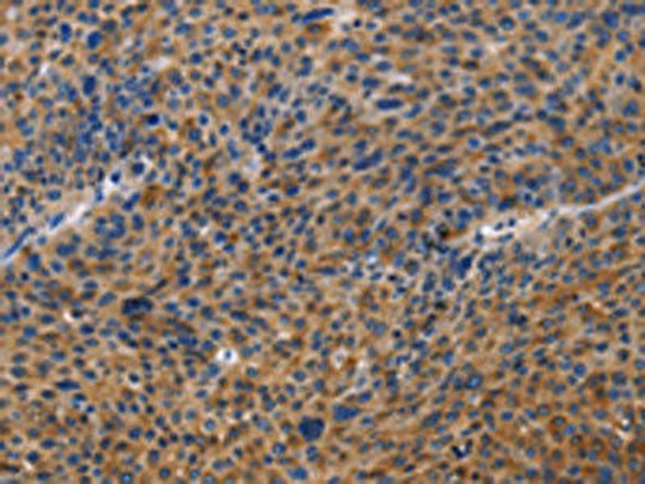 MUSK Antibody (PACO15671)