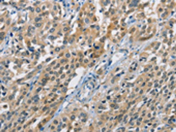 CBR1 Antibody (PACO15760)