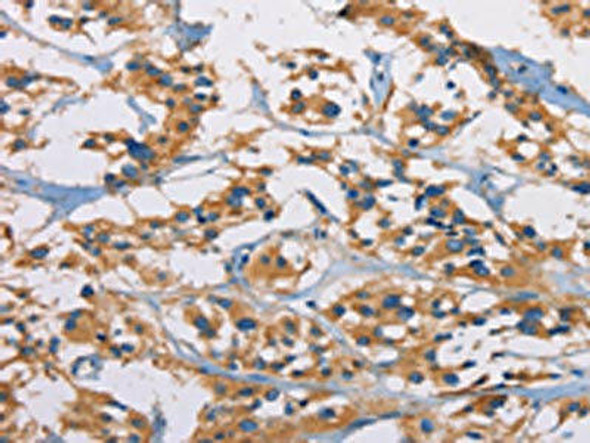CERK Antibody (PACO15771)