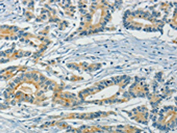 ASAH2 Antibody (PACO15780)