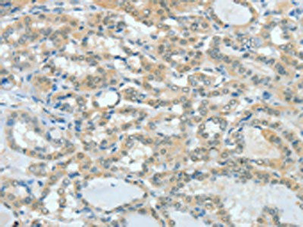 ASH2L Antibody (PACO15790)