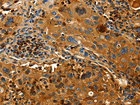 ORM2 Antibody (PACO15807)