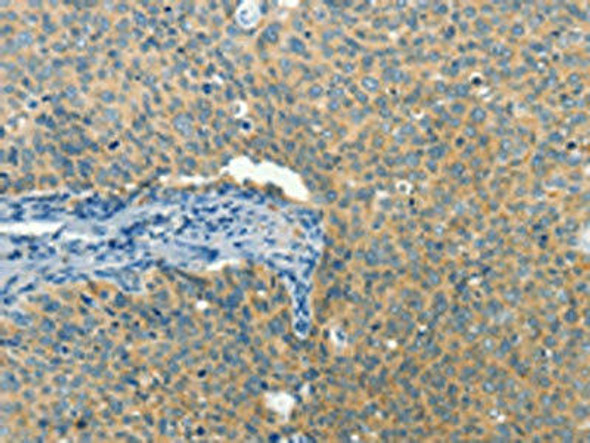 BCAT1 Antibody (PACO15853)