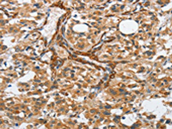 BUB1 Antibody (PACO15894)