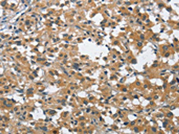 BUB1 Antibody (PACO15895)