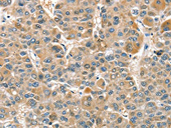 CIAPIN1 Antibody (PACO16031)