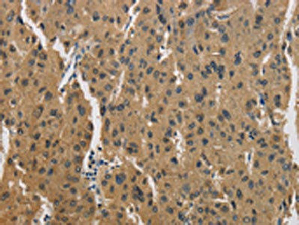 CKMT2 Antibody (PACO16041)