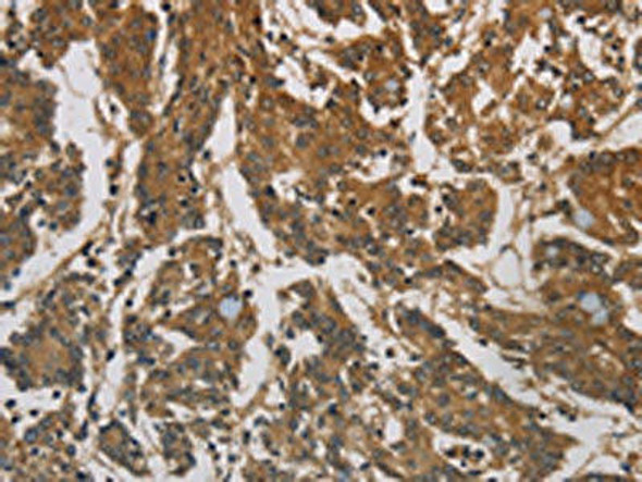 CORO1C Antibody (PACO16058)