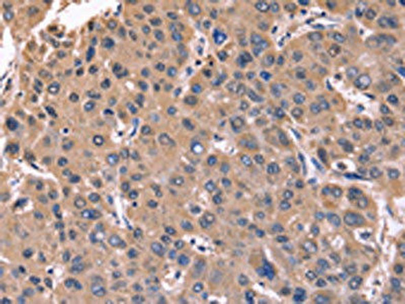 CSNK1D Antibody (PACO16079)