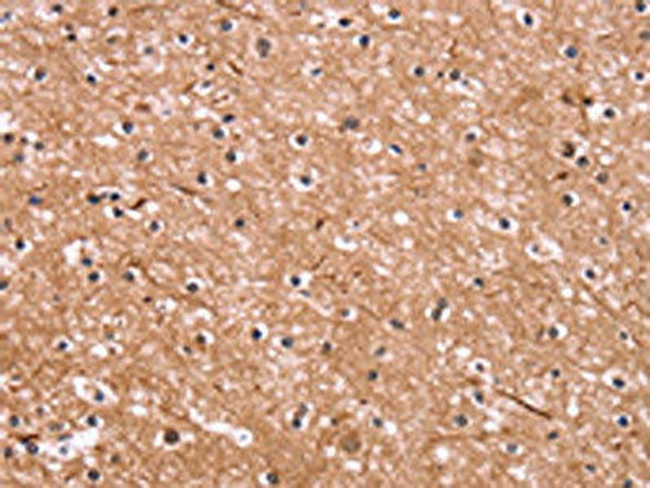 CSNK1D Antibody (PACO16080)