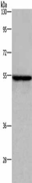 ETS2 Antibody (PACO16280)