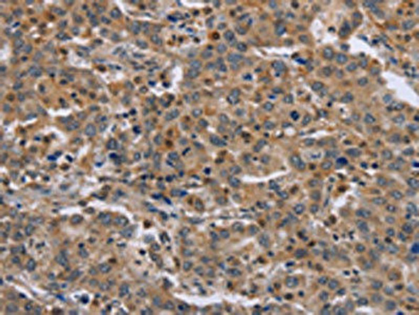 ETV7 Antibody (PACO16282)