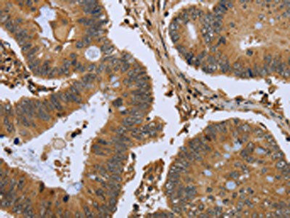 FHL2 Antibody (PACO16353)