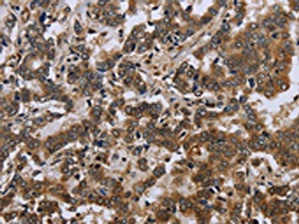 FMR1 Antibody (PACO16369)