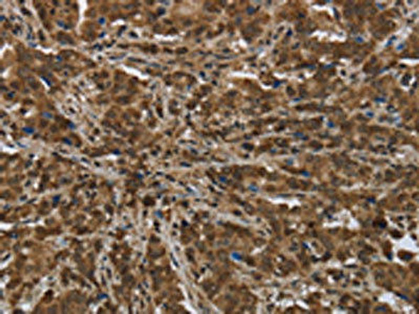 PIP Antibody (PACO16399)