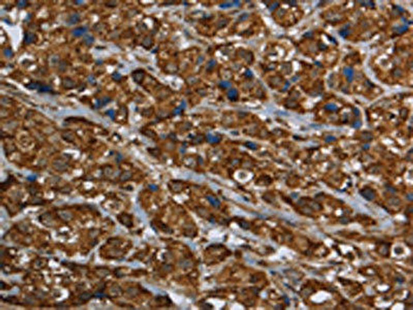 GCKR Antibody (PACO16404)