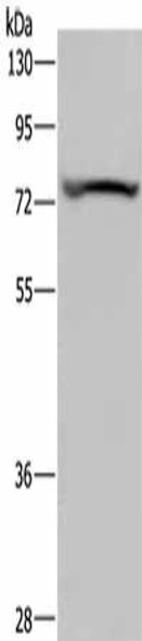 KCNQ1 Antibody (PACO16582)