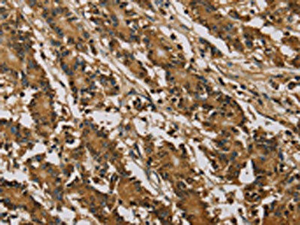 PSMC2 Antibody (PACO16708)